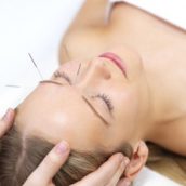 Fertility Acupuncture